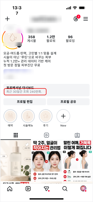 피부 에스테틱 인스타 레퍼런스
